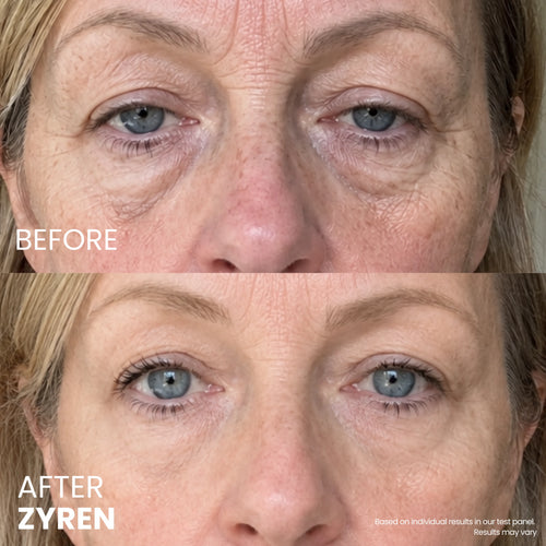Zyren® Contour Lift Eye Cream