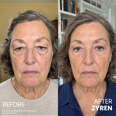 Zyren® Contour Lift Eye Cream