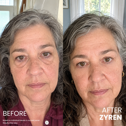Zyren® Contour Lift Eye Cream