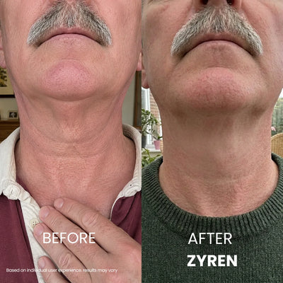 Zyren® Tighten & Lift Neck Cream [m]