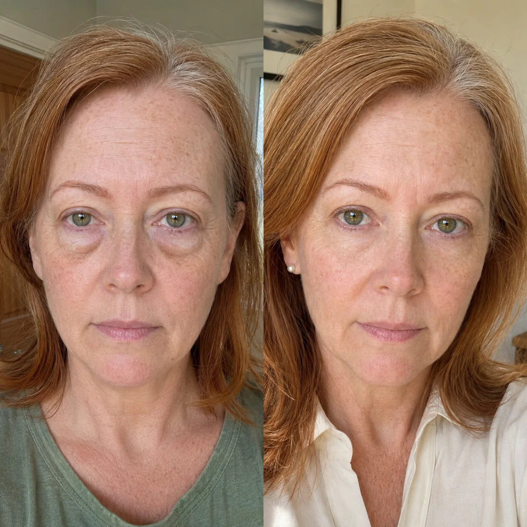 Applying the cream along the under-eye