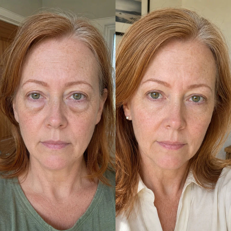 4. Smooths Fine Lines And Brightens Dark Circles Too