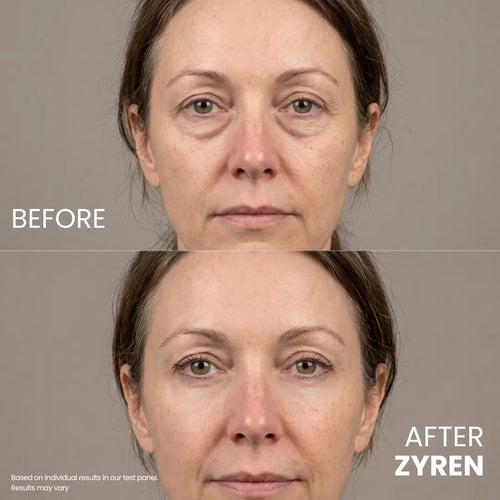 Zyren® Contour Lift Eye Cream