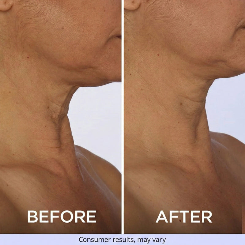 7. It Delivers Remarkable Results For Women Of All Ages