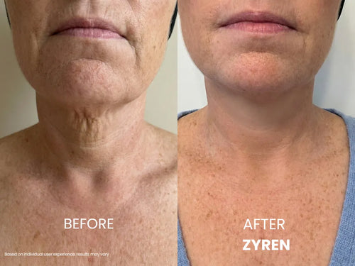 Tighten & Lift Neck Cream