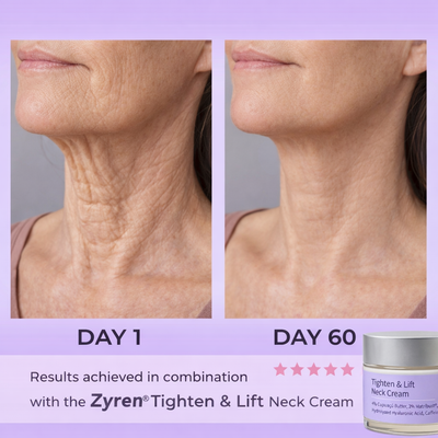 Zyren® LED Facial Sculptor
