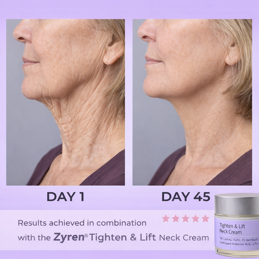 Zyren® LED Facial Sculptor