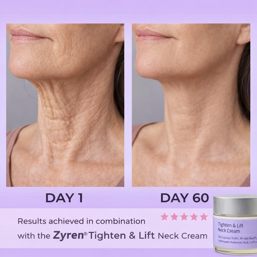 Zyren® LED Facial Sculptor