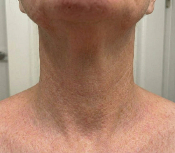 After 4 weeks
