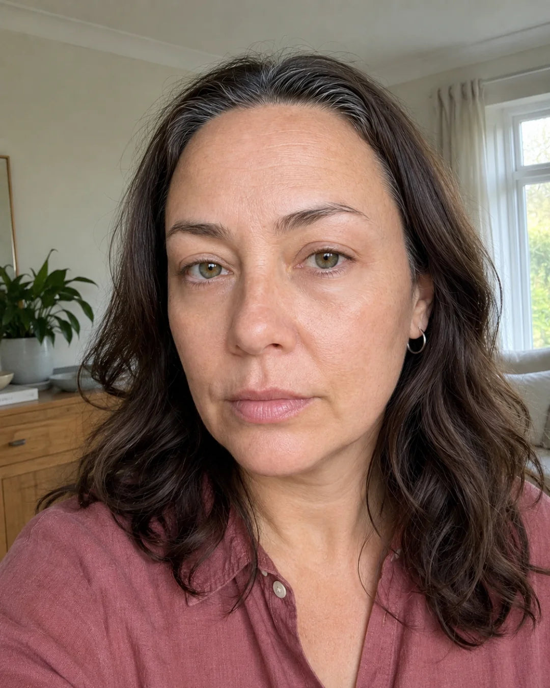Under-eye area after using Zyren eye cream, participant 2