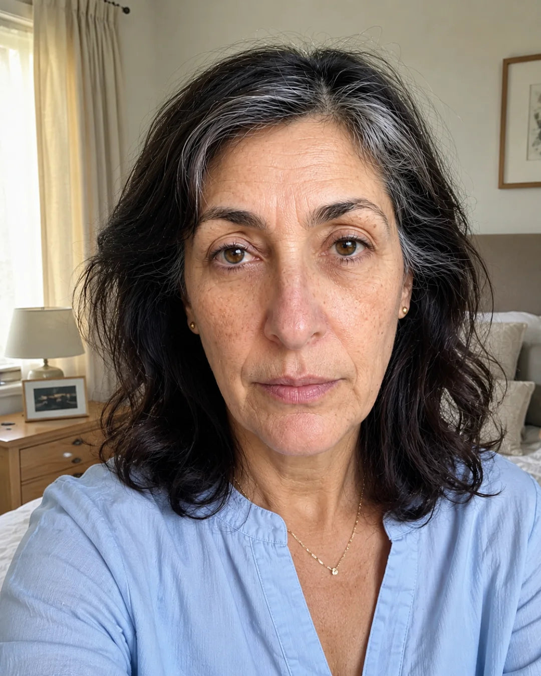 Under-eye area after using Zyren eye cream, participant 5