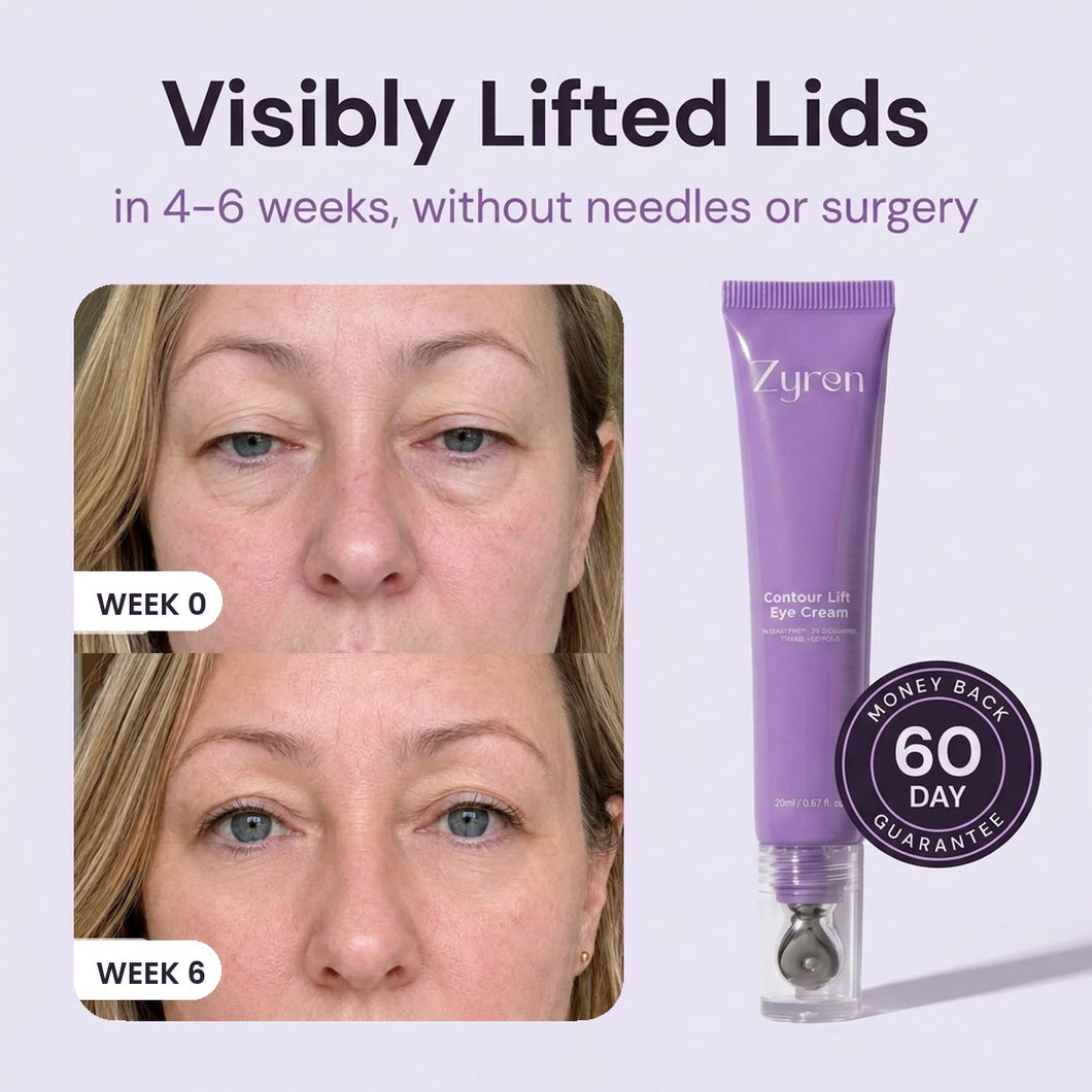 Visibly lifted hooded lids in 4-6 weeks, week 0 and week 6